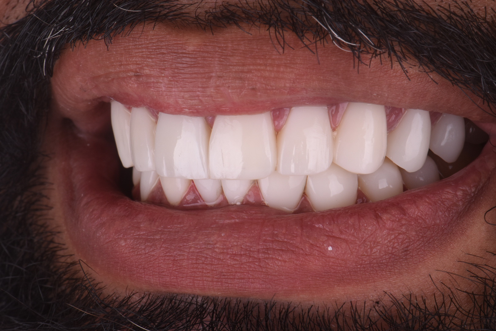 Periodontics After